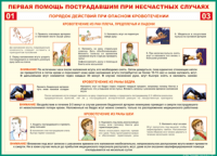 Таблица "Порядок действий при опасном кровотечении" (100х140 сантиметров, винил) - fgospostavki.ru - Первоуральск